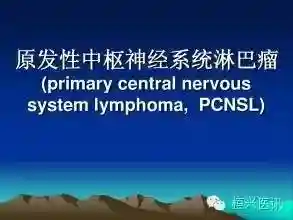 《柳叶刀》：大剂量化疗联合自体造血干细胞移植治疗淋巴瘤
